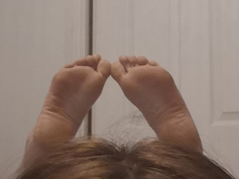 feetfungusfoot onlyfans leaked picture 2